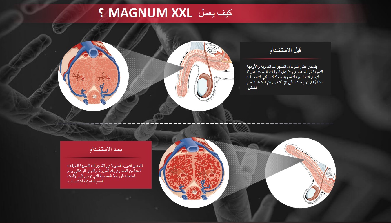 كيف يعمل MAGNUM XXL؟ قبل الاستخـداميتعـذر على الدم ملء الشعيرات الدموية والأوعية الدموية في القضيب. ولا تنقل النهايات العصبية تقريبًا الإشارات الكهربائية، ونتيجة لذلك، يأتي الانتصاب متأخرًا أو لا يحدث على الإطلاق، ويتم استنفاد الجسم الكهفي.بعـد الاستخـدام تتحسن الدورة الدموية في الشعيرات الدموية للطبقات العليا من الجلد وتزداد المرونة والتوتر الوعائي ويتم استعادة الروابط العصبية التي تؤدي إلى الآليات النفسية-البدنية للانتصاب. 